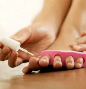 Aplikácia terapeutického laku